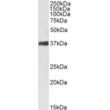 Western Blot - Anti-Nucleophosmin Antibody (A83388) - Antibodies.com
