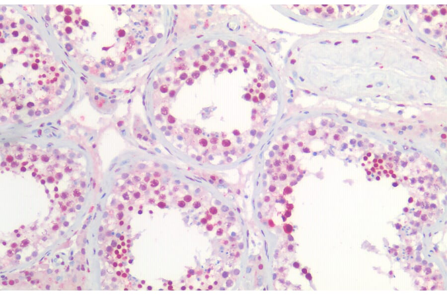 Immunohistochemistry - Anti-Nucleophosmin Antibody (A83388) - Antibodies.com