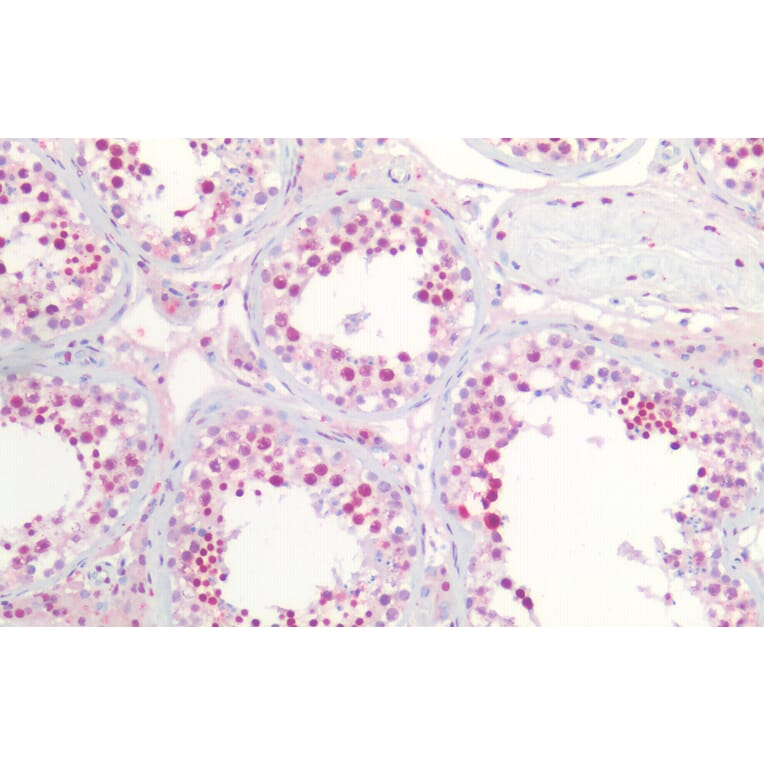 Immunohistochemistry - Anti-Nucleophosmin Antibody (A83388) - Antibodies.com