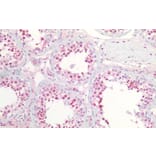 Immunohistochemistry - Anti-Nucleophosmin Antibody (A83388) - Antibodies.com