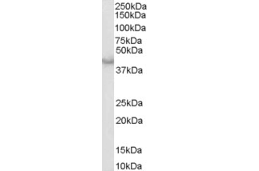 Western Blot - Anti-Caspase-4 Antibody (A83389) - Antibodies.com