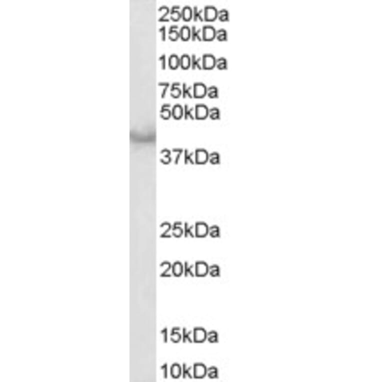 Western Blot - Anti-Caspase-4 Antibody (A83389) - Antibodies.com