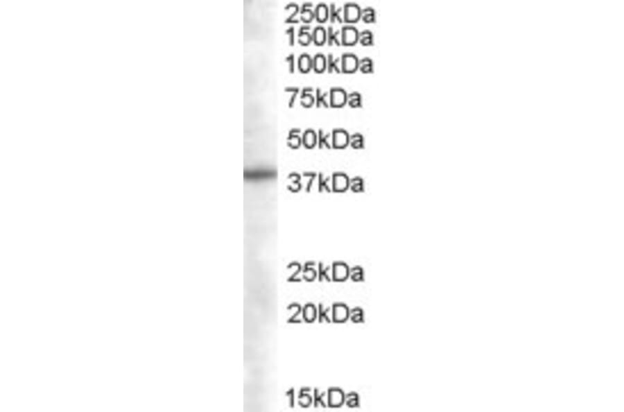 Western Blot - Anti-SNX16 Antibody (A83390) - Antibodies.com