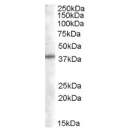 Western Blot - Anti-SNX16 Antibody (A83390) - Antibodies.com