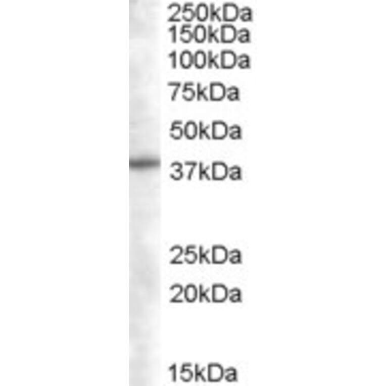 Western Blot - Anti-SNX16 Antibody (A83390) - Antibodies.com