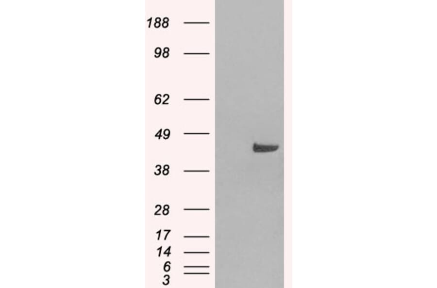 Western Blot - Anti-SNX16 Antibody (A83390) - Antibodies.com