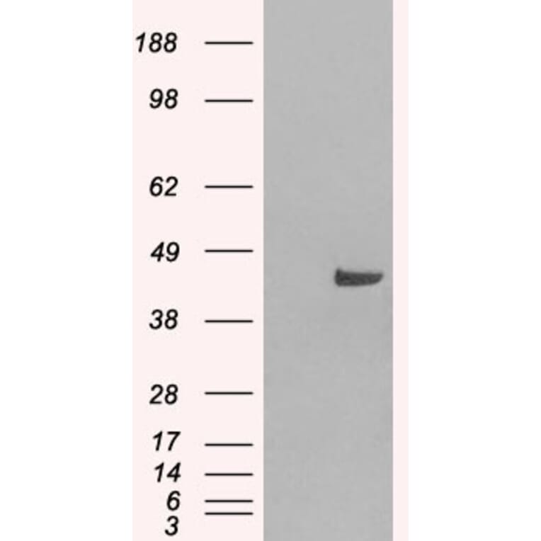 Western Blot - Anti-SNX16 Antibody (A83390) - Antibodies.com