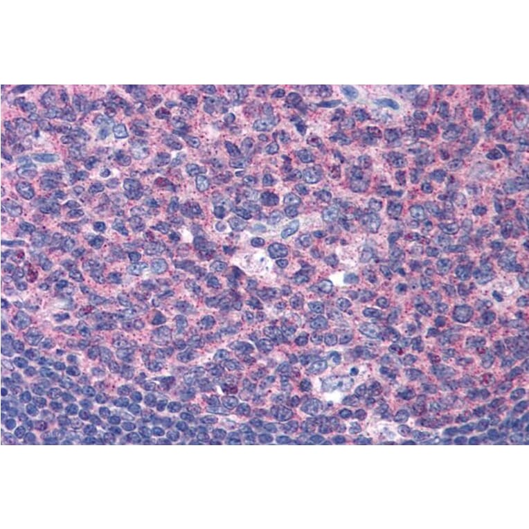 Immunohistochemistry - Anti-SNX16 Antibody (A83390) - Antibodies.com