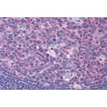 Immunohistochemistry - Anti-SNX16 Antibody (A83390) - Antibodies.com