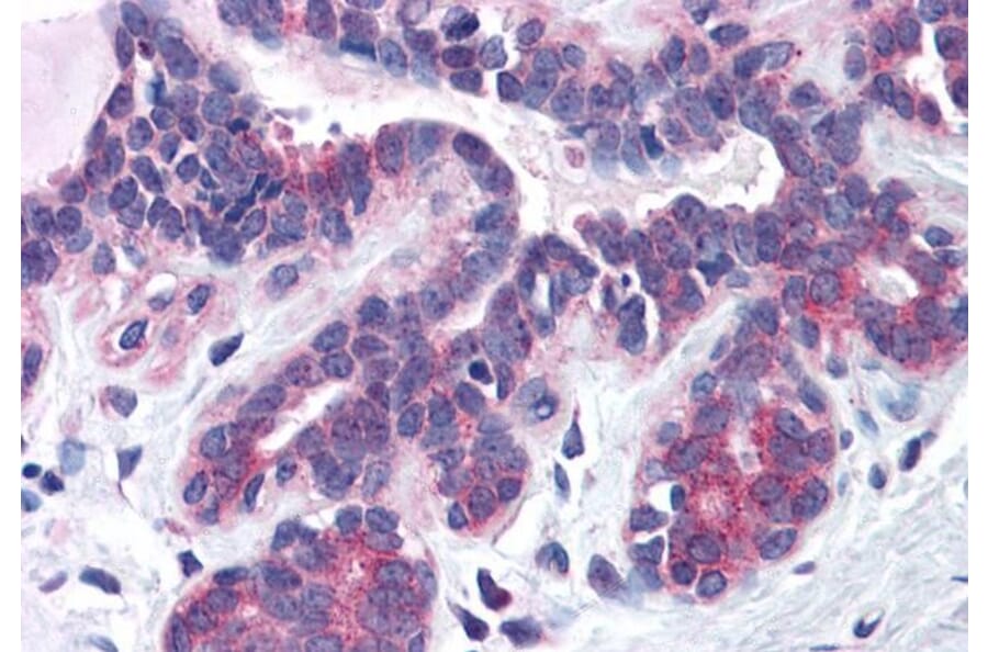 Immunohistochemistry - Anti-SNX16 Antibody (A83390) - Antibodies.com
