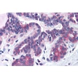 Immunohistochemistry - Anti-SNX16 Antibody (A83390) - Antibodies.com