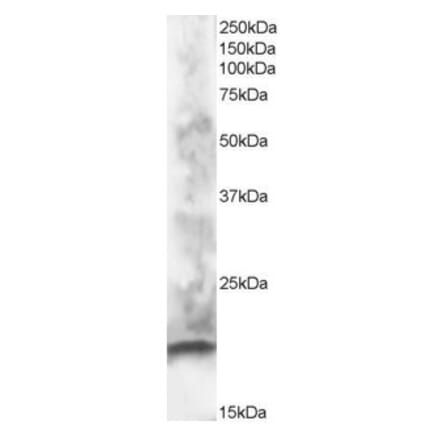 Western Blot - Anti-CABP Antibody (A83391) - Antibodies.com