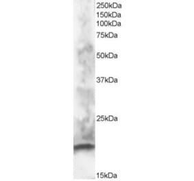 Western Blot - Anti-CABP1 Antibody (A83391) - Antibodies.com