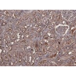 Immunohistochemistry - Anti-MID2 Antibody (A83394) - Antibodies.com