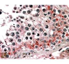 Immunohistochemistry - Anti-ABCB9 Antibody (A83396) - Antibodies.com