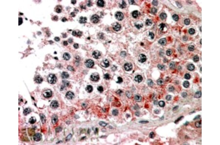Immunohistochemistry - Anti-ABCB9 Antibody (A83396) - Antibodies.com