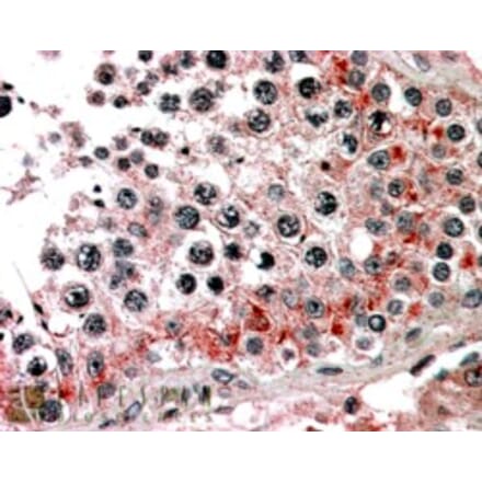 Immunohistochemistry - Anti-ABCB9 Antibody (A83396) - Antibodies.com