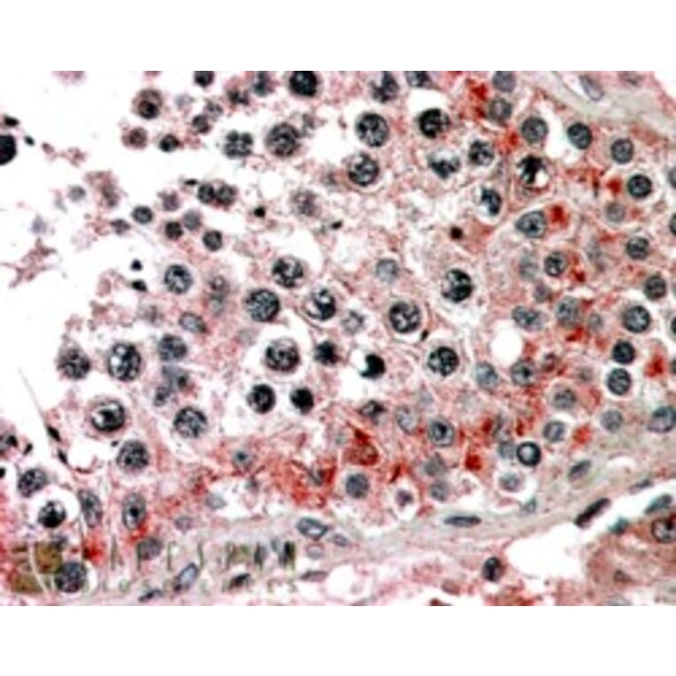 Immunohistochemistry - Anti-ABCB9 Antibody (A83396) - Antibodies.com