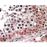 Immunohistochemistry - Anti-ABCB9 Antibody (A83396) - Antibodies.com