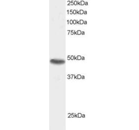 Western Blot - Anti-SNX15 Antibody (A83397) - Antibodies.com