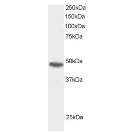 Western Blot - Anti-SNX15 Antibody (A83397) - Antibodies.com