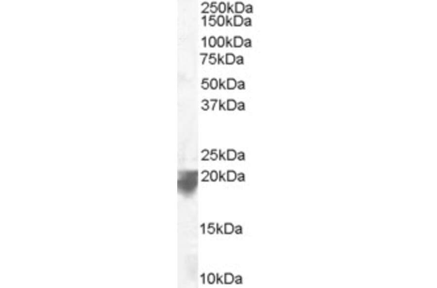 Western Blot - Anti-VPS29 Antibody (A83398) - Antibodies.com