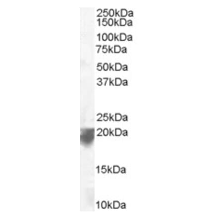 Western Blot - Anti-VPS29 Antibody (A83398) - Antibodies.com