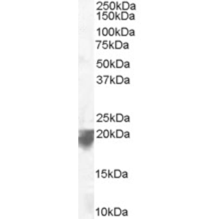 Western Blot - Anti-VPS29 Antibody (A83398) - Antibodies.com