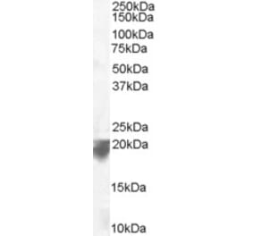 Western Blot - Anti-VPS29 Antibody (A83398) - Antibodies.com