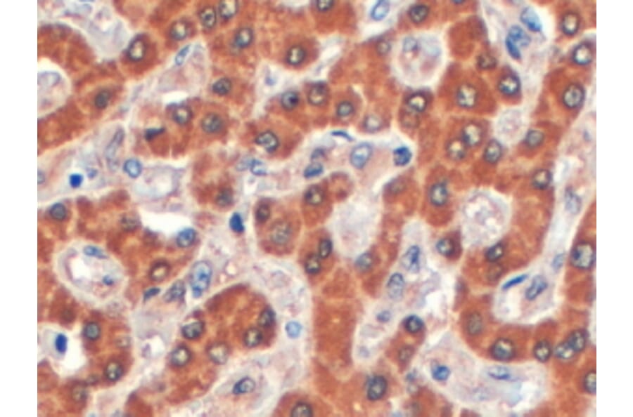 Immunohistochemistry - Anti-Syntenin 2 Antibody (A83399) - Antibodies.com
