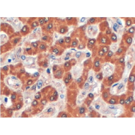 Immunohistochemistry - Anti-Syntenin 2 Antibody (A83399) - Antibodies.com