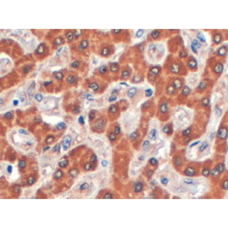 Immunohistochemistry - Anti-Syntenin 2 Antibody (A83399) - Antibodies.com