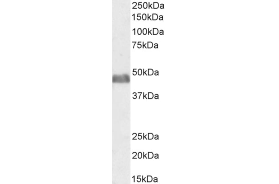 Western Blot - Anti-BAF53A + BAF53B Antibody (A83400) - Antibodies.com