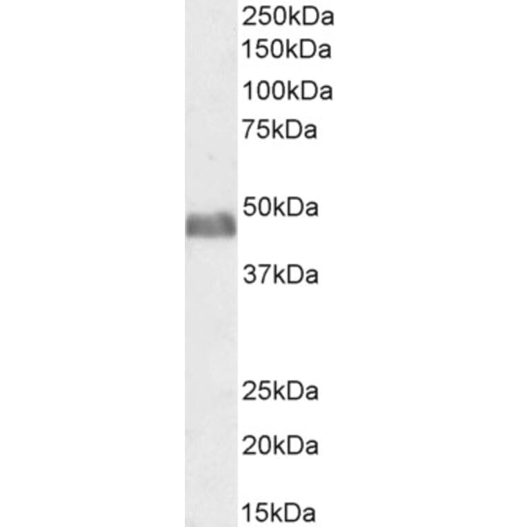 Western Blot - Anti-BAF53A + BAF53B Antibody (A83400) - Antibodies.com