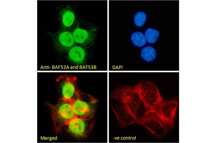 Immunofluorescence - Anti-BAF53A + BAF53B Antibody (A83400) - Antibodies.com