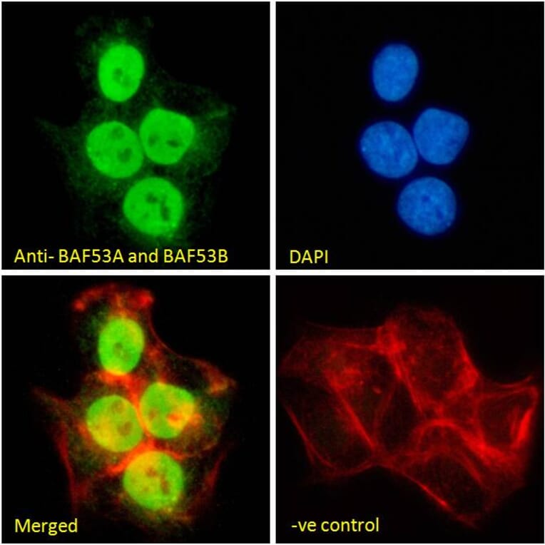 Immunofluorescence - Anti-BAF53A + BAF53B Antibody (A83400) - Antibodies.com