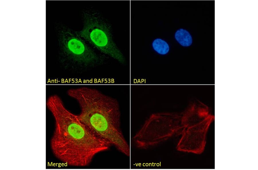Immunofluorescence - Anti-BAF53A + BAF53B Antibody (A83400) - Antibodies.com