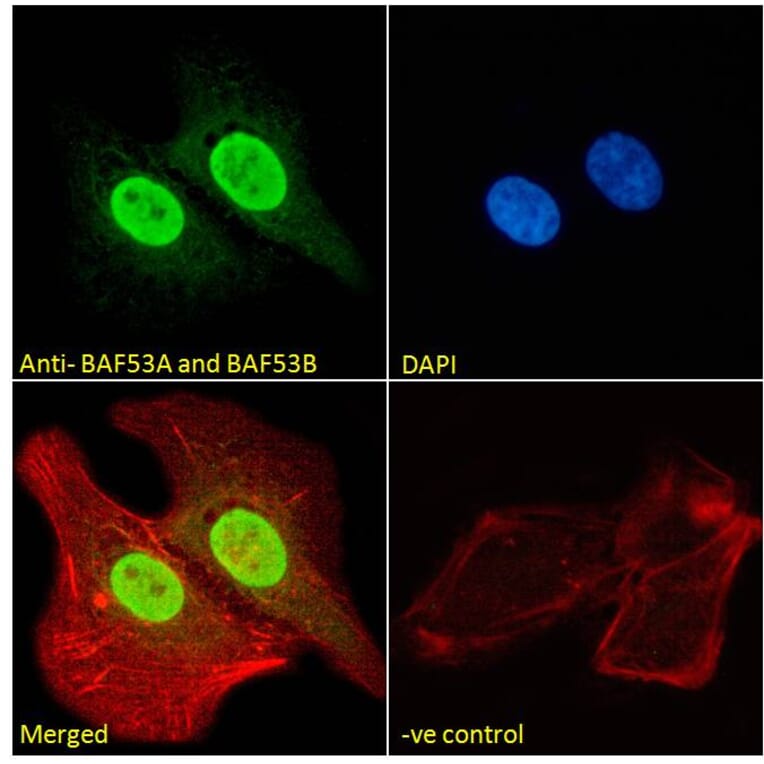 Immunofluorescence - Anti-BAF53A + BAF53B Antibody (A83400) - Antibodies.com