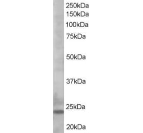 Western Blot - Anti-Bim Antibody (A83401) - Antibodies.com