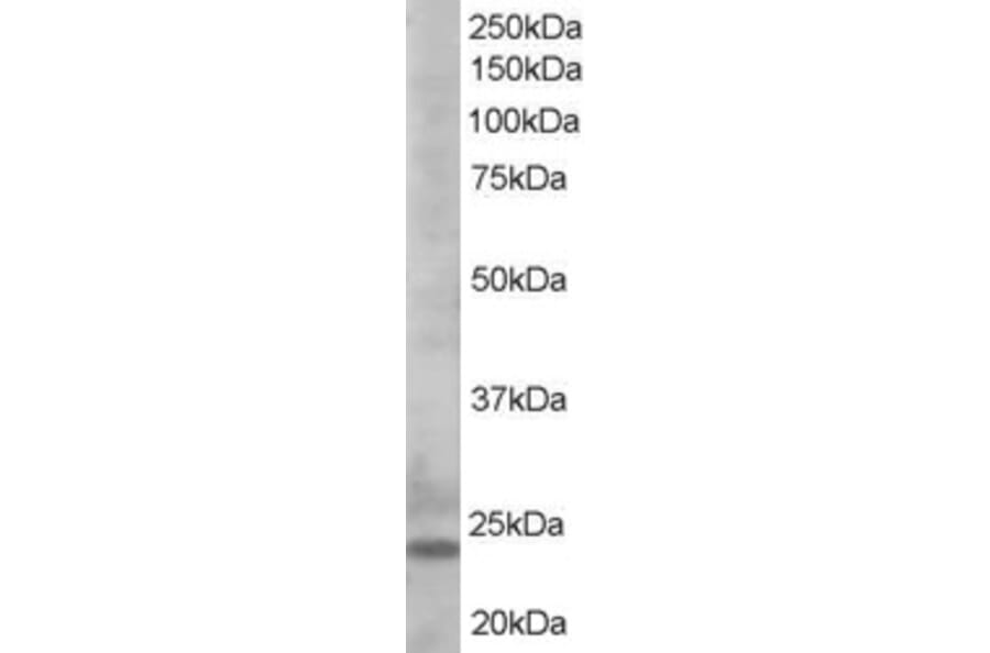 Western Blot - Anti-Bim Antibody (A83401) - Antibodies.com