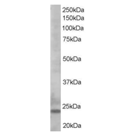Western Blot - Anti-Bim Antibody (A83401) - Antibodies.com