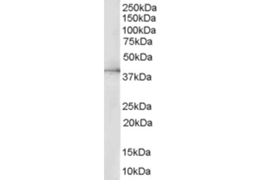 Western Blot - Anti-ERK2 Antibody (A83402) - Antibodies.com