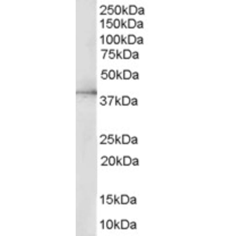 Western Blot - Anti-ERK2 Antibody (A83402) - Antibodies.com