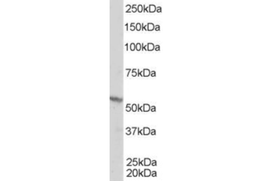 Western Blot - Anti-RXRB Antibody (A83403) - Antibodies.com