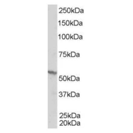 Western Blot - Anti-RXRB Antibody (A83403) - Antibodies.com