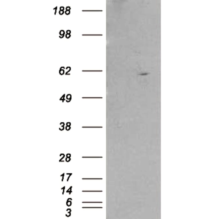 Western Blot - Anti-RXRB Antibody (A83403) - Antibodies.com