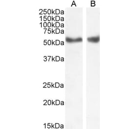 Western Blot - Anti-LXR alpha + LXR beta Antibody (A83404) - Antibodies.com