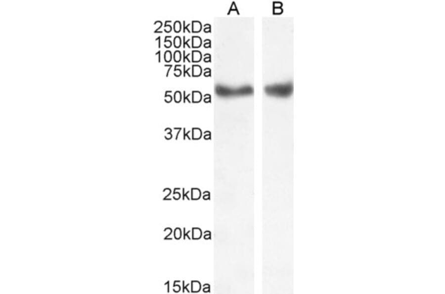 Western Blot - Anti-LXR alpha + LXR beta Antibody (A83404) - Antibodies.com