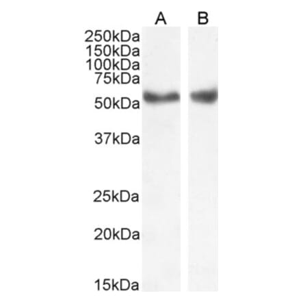 Western Blot - Anti-LXR alpha + LXR beta Antibody (A83404) - Antibodies.com