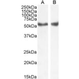 Western Blot - Anti-LXR alpha + LXR beta Antibody (A83404) - Antibodies.com